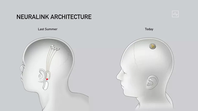 Thiết bị của Neuralink vẫn giới hạn ở bề mặt não